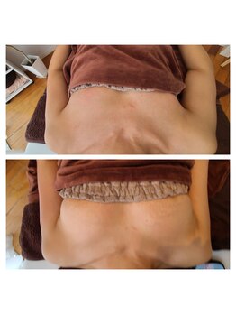 イベリス(IBERIS.)/当店ビフォーアフター