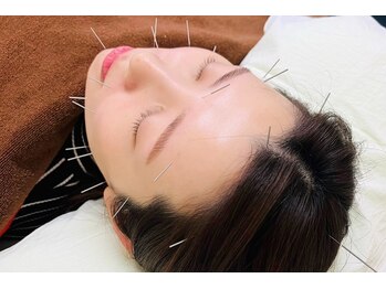 命水鍼灸院/美容鍼【新宿/鍼灸】