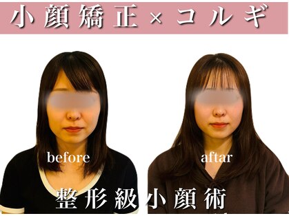 オルグル(OLGUL)の写真