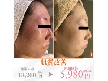 アンジェラックス 松本南店