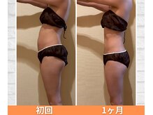 ヨサパーク スリアン(YOSA PARK Souriant)/お客様の変化♪