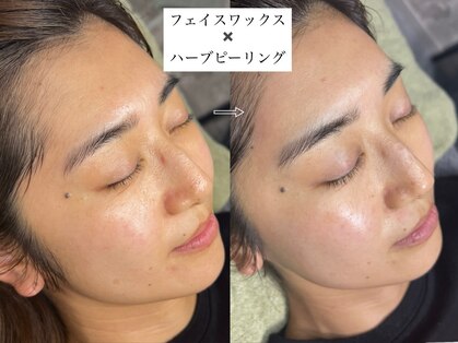 ラダ(RADA)の写真