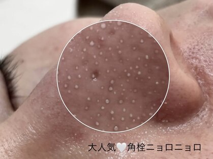 ポアラ(POARA)の写真