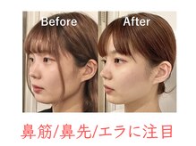 ラプリ 福岡天神店(Raplit)の雰囲気( フォトのラインQRで無料相談受付中!美鼻/小顔/天神/大名)