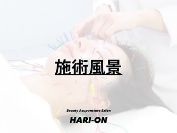 ハリオン 中目黒(HARI-ON)/施術風景