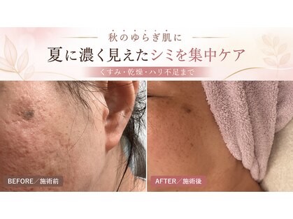 ステラフィールド(stella field)の写真