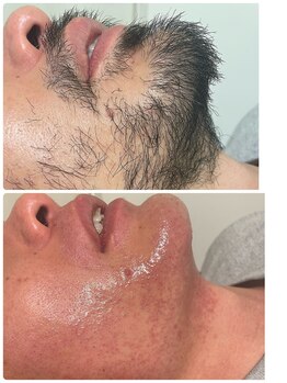 エン(en.)/BeforeAfter写真8