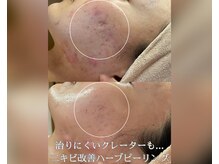 レーヴ(REVE)の雰囲気(一人一人に合わせたオーダーメイドハーブで改善を早めます!)