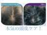 4箇所から1箇所選べる〈頭皮ケア〉育毛を促し白髪軽減も期待できる頭皮棘ケア
