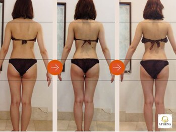 アテナ 池袋西口店(ATHENA)/施術比較!圧倒的結果重視♪