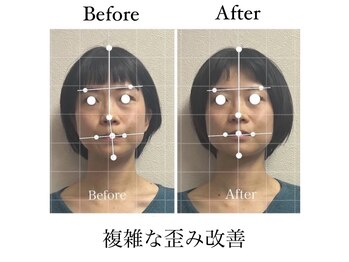 ラボーテヴェリテ(La Beaute Verite)/【お客様施術例】