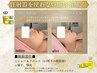 【脂肪分解レモンボトル】レモンボトル注入2cc　顔全体の脂肪が気になる方！