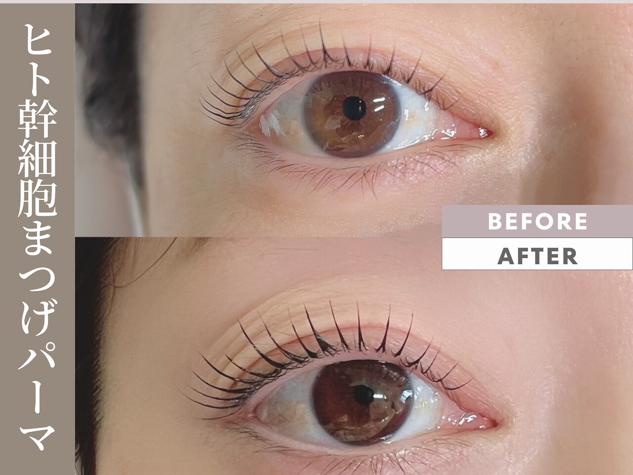 アイビービューティーパートナー アイビー ビューティ パートナー〈家庭用複合美容器〉 | 機器 | 商品