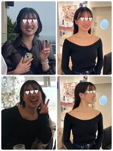 パルティール 銀座店 partir/パスリルリュクスの効果【銀座】