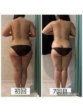 エクラ(Eclat)/Eclatの痩身★BeforeAfter11