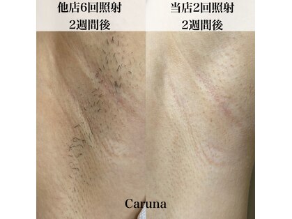 カルナ(Caruna)の写真