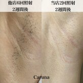 カルナ(Caruna)