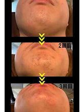 リベルテ(Liberte)/ヒゲ職人