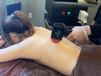 ルナステラ 七尾店の写真/痛みが少ないLED脱毛を使用しているので、初めての方にもオススメ！脱毛とともに古い角質も除去します◎