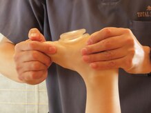 初田鍼院 恵比寿/足裏ファンクショナルカッピング