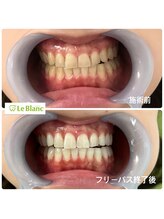 ルブラン 奈良店(Le Blanc)/フリーパスコース！