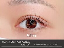 キンバリー 乃木坂店(KIMBERLY)/ヒト幹細胞培養液ラッシュリフト