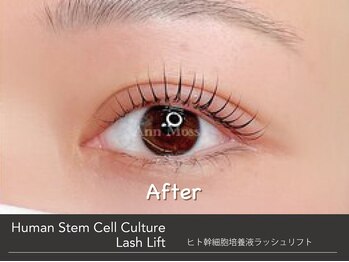 キンバリー 乃木坂店(KIMBERLY)/ヒト幹細胞培養液ラッシュリフト