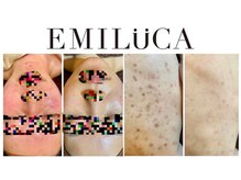 エミルカ 自由が丘店(EMILUCA)