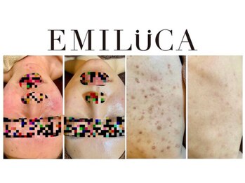 エミルカ 自由が丘店(EMILUCA)
