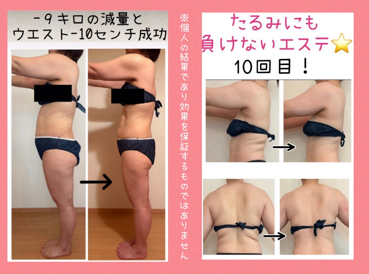 横浜市泉区でキャビテーションが人気のエステサロン｜ホットペッパー