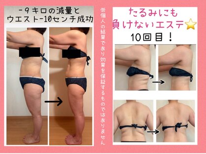 ピースツリー(PEACE TREE)の写真