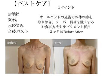 サロンツキ(salon tuki)/バストケア/バストアップ/徳島