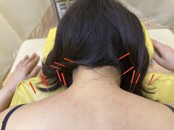 CA鍼灸整骨院の写真/姿勢改善ストレッチ/はり施術で首・肩こりの根本改善へ◇葛西エリア希少「自律神経をととのえるはり」◎