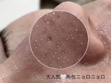 ポアラ(POARA)の雰囲気（毛穴/ハーブピーリング/ワックス脱毛/ピーリング）