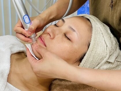 アメリテ(Amelite)の写真