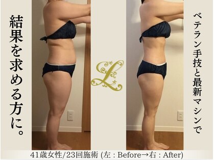 ル リアン(Le Lien)の写真