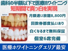 スマイルホワイト 練馬店