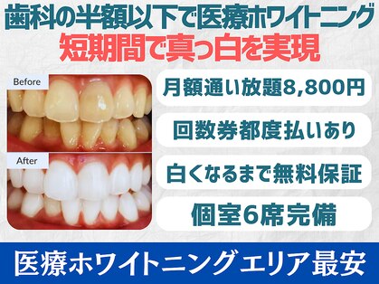 スマイルホワイト 練馬店の写真