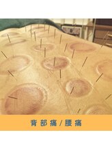 いつつのき/カッピング×鍼