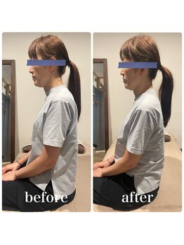 フィジオリハ 久屋大通店/ストレートネック/筋膜リリース