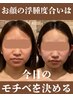 【小顔セットメニュー】お顔を小さくしたい！