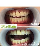 ルブラン 奈良店(Le Blanc)/チョコレートの着色！