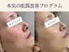 【7日間でモチモチ赤ちゃん肌に！肌質改善コース】ローズドメーラ￥11000～