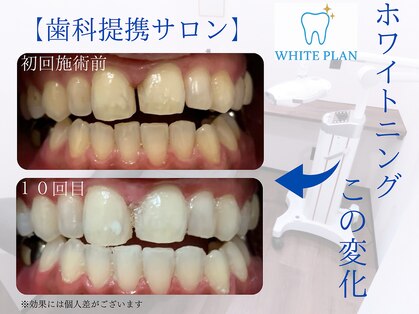 ホワイトプランの写真