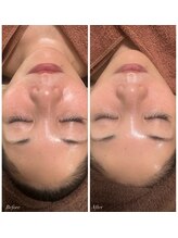 シャナ(Shana)/ラミネーションピール