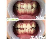 ルブラン 奈良店(Le Blanc)/初回の方格安！！