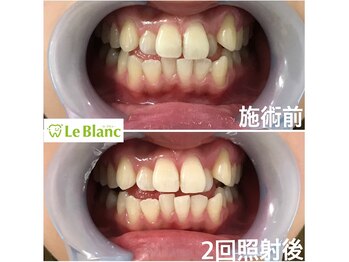 ルブラン 奈良店(Le Blanc)/初回の方格安!!