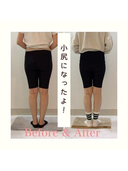 スタイルラボ高松/産後の骨盤矯正の効果♪
