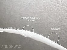 ポアラ(POARA)の雰囲気（毛穴/ハーブピーリング/ワックス脱毛/ピーリング）