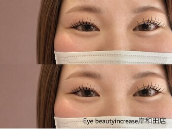 アイ ビューティー インクリース 岸和田店(Eye beauty increase)/&healthy★アンドヘルシー